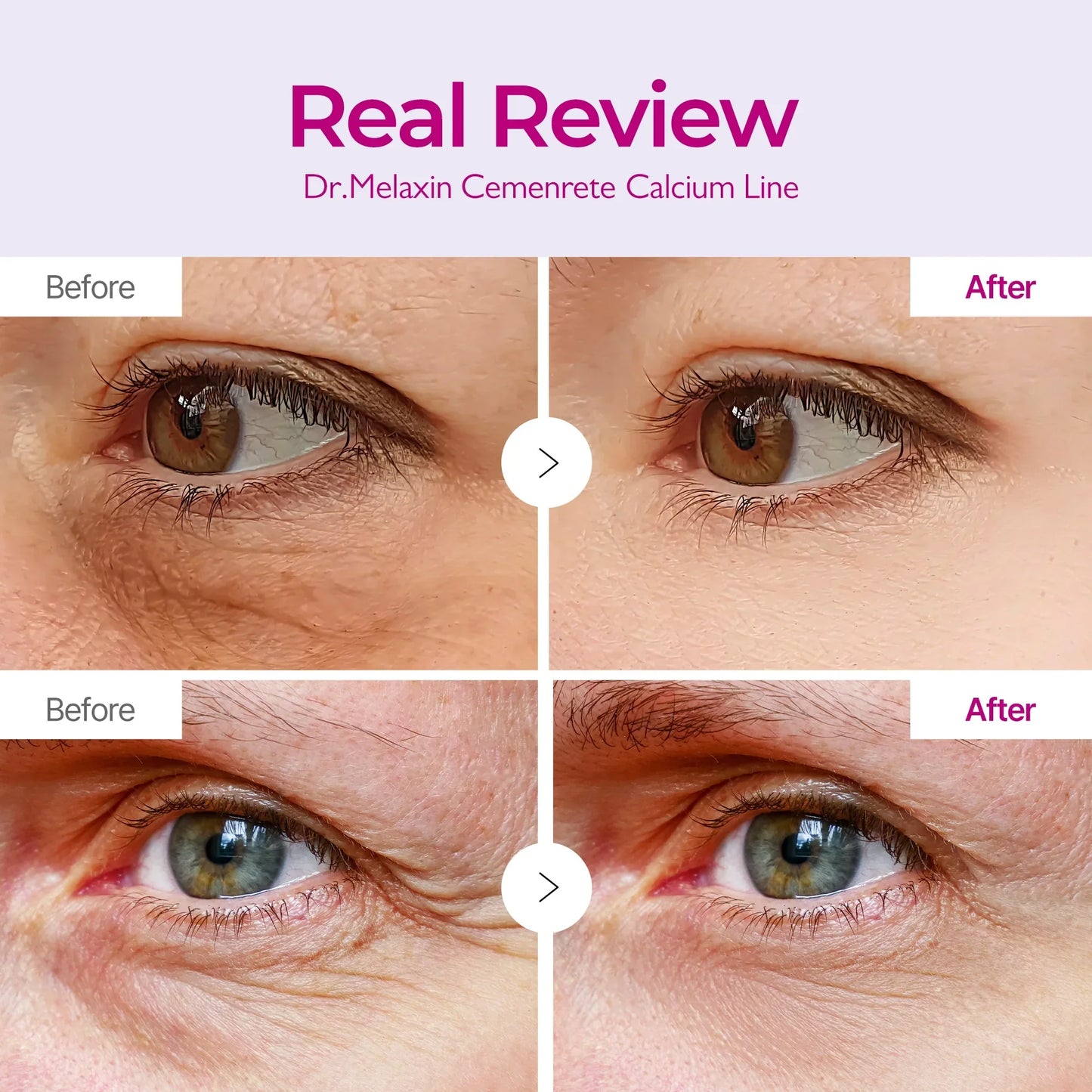 Pack Dr. Melaxin Calcium Volume Multi Balm + Eye Patch